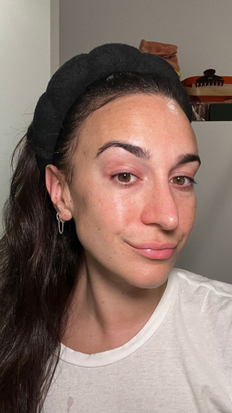 Wohlner with freshlycleansed skin before using the PanOxyl Acne Treatment Bar
